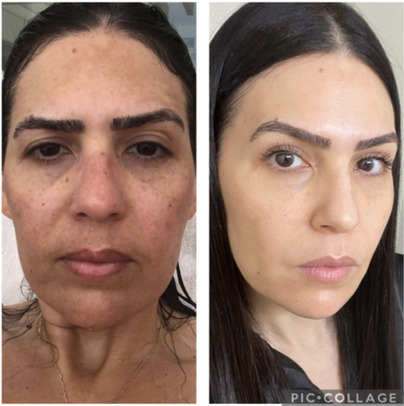 My Results using 20-80 skincare
