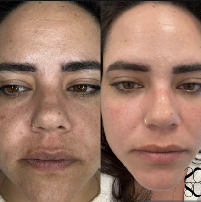 Results using 20-80 skincare